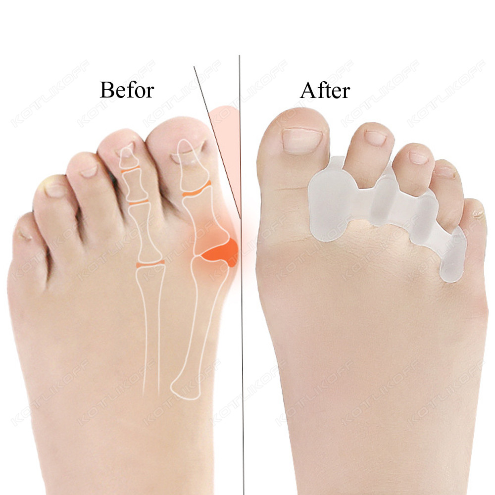 Toe Protective Toes Separator  - đánh giá và giá Shoe Polish Cream