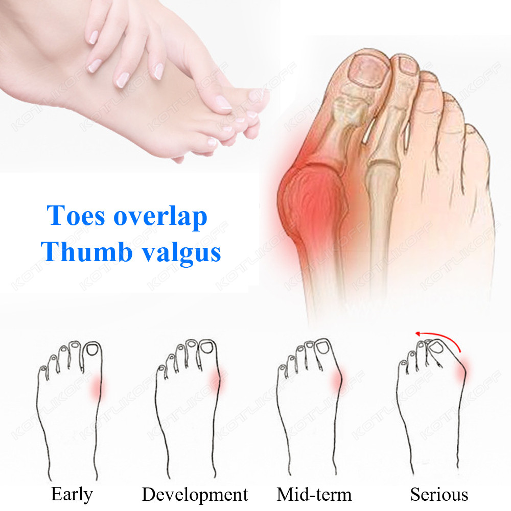 Toe Protective Toes Separator  - đánh giá và giá Shoe Polish Cream